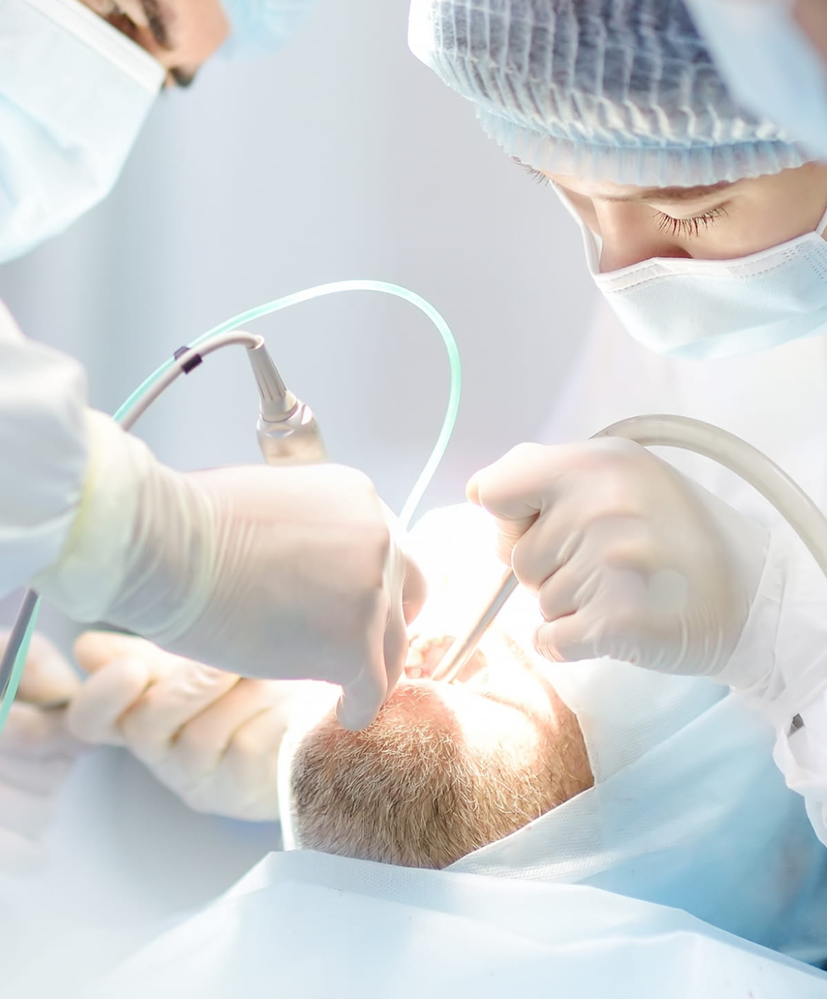 Root Canal Surgery