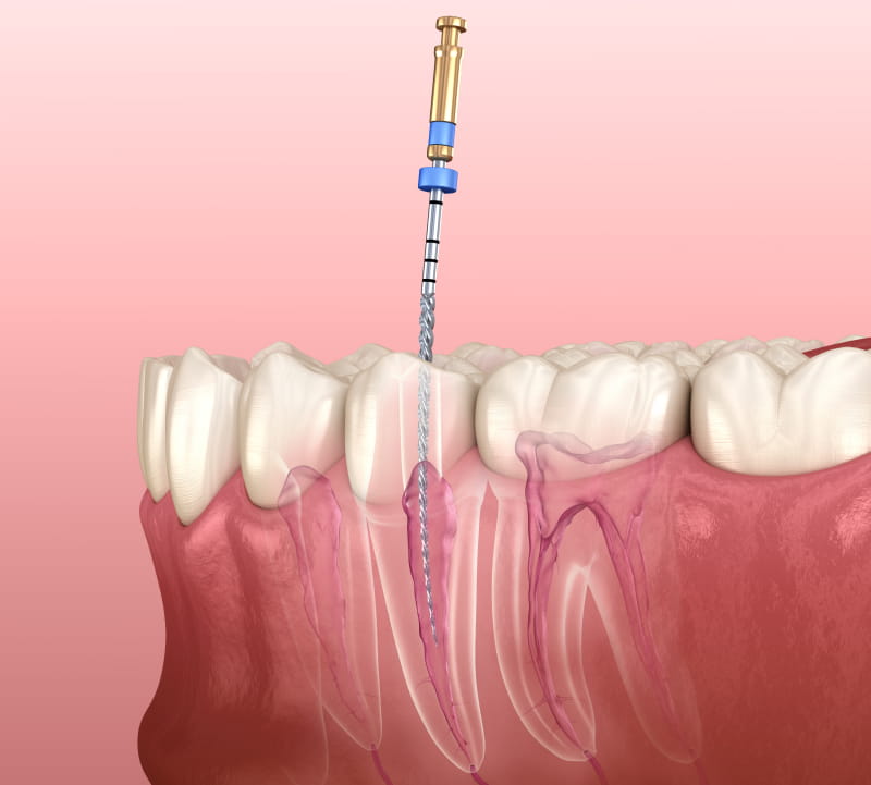 North Palm Beach Endodontists Orange Dental Partners